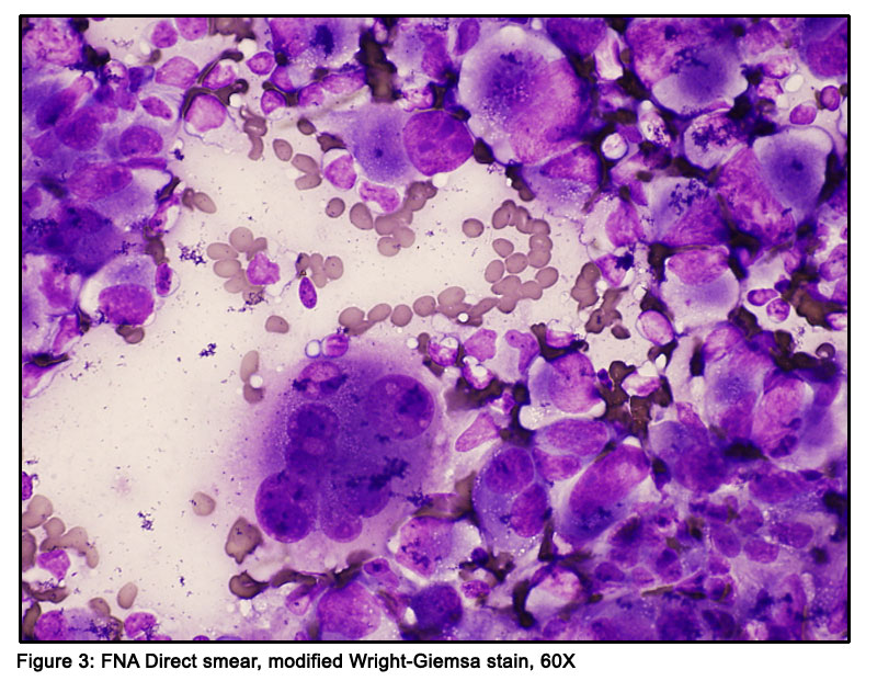 Final Diagnosis & Discussion