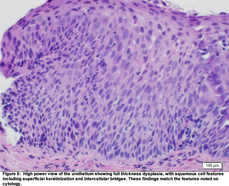 ARUP Scientific Resource for Research and Education: Case Report: Urine ...