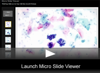 Launch Viewer
