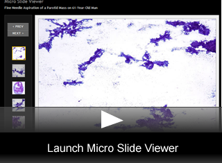 Launch Viewer