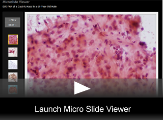 Launch Viewer